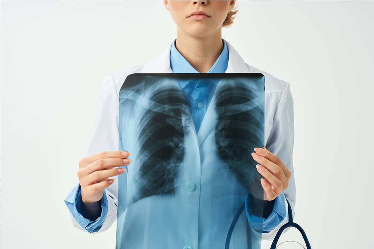 Asthma CXR: 5 Key Findings Explained