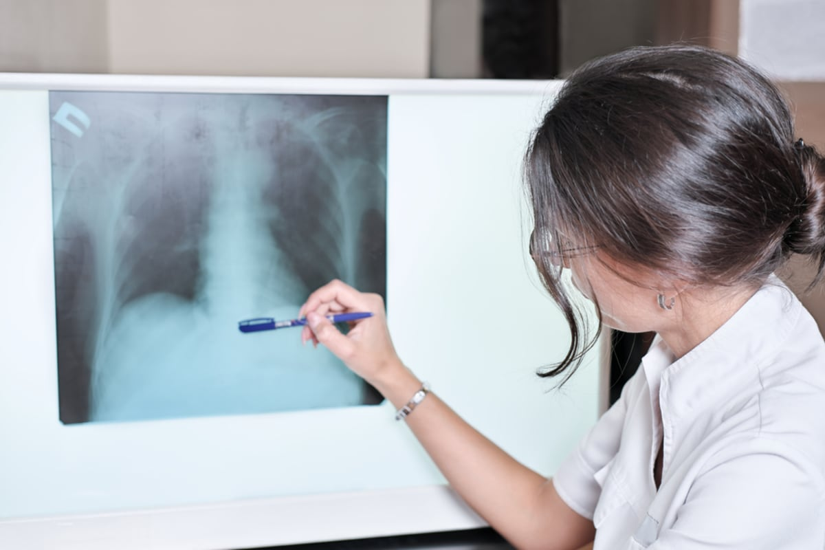 Asthma Attack Chest X Ray: Key Findings