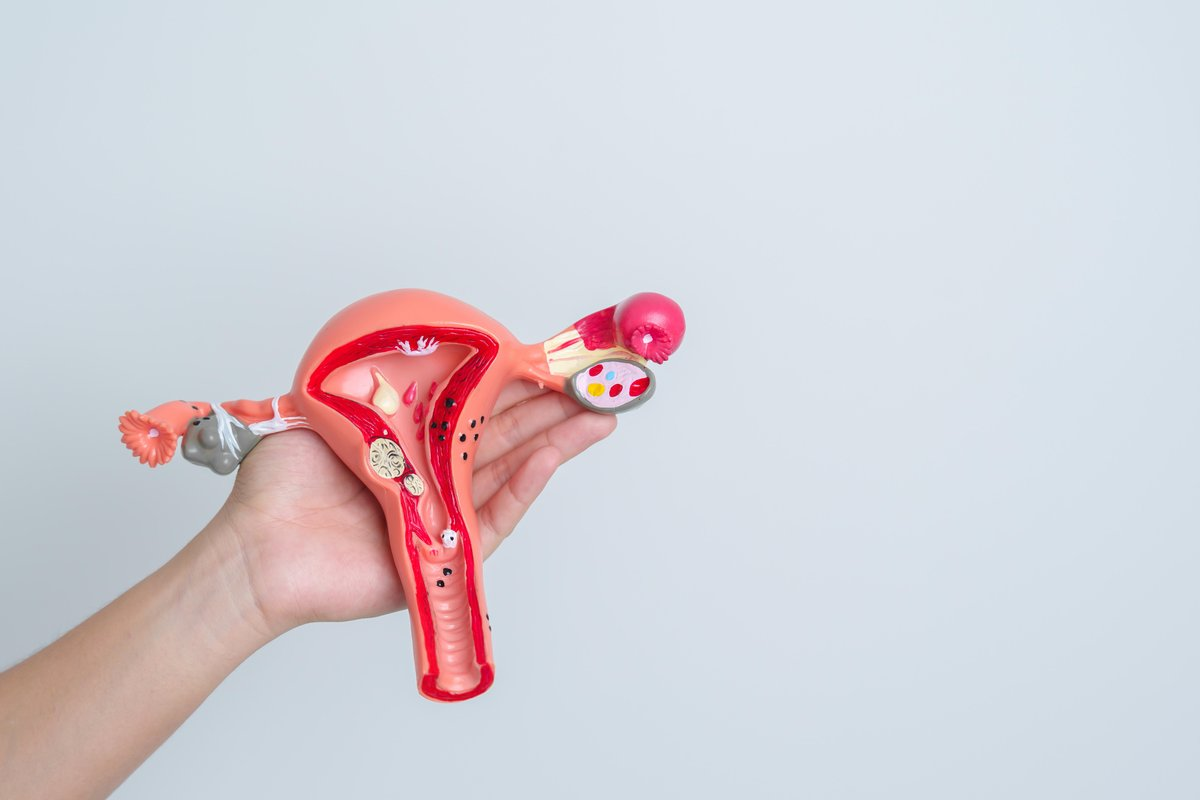 Simple How To Treat Prolapsed Uterus: Signs & Solutions 3 Simple How To Treat Prolapsed Uterus: Signs & Solutions