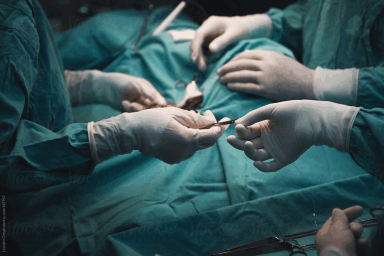 How to Exercise After CABG Surgery: A Safe Recovery Guide