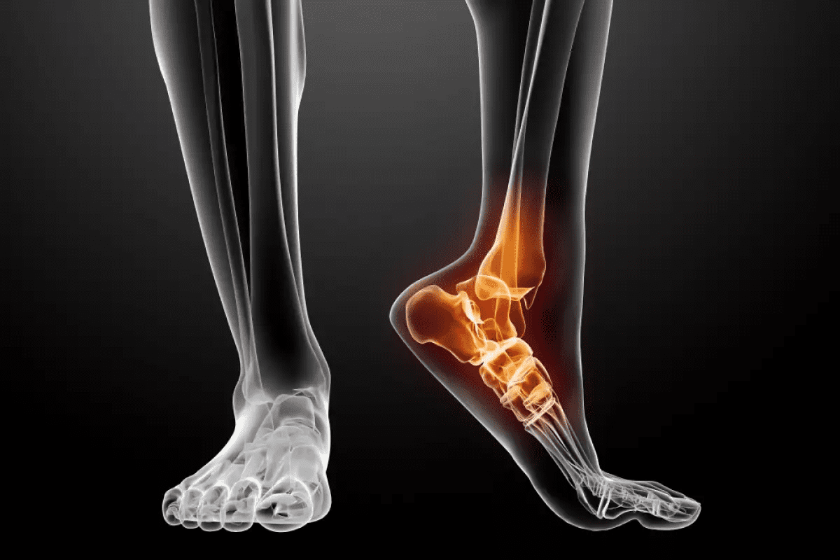 Essential Foot Physical Therapy Exercises For Stretching