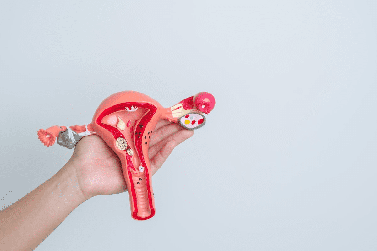 Complete Exercises For Tipped Uterus: How To Fix It 2 Complete Exercises For Tipped Uterus: How To Fix It