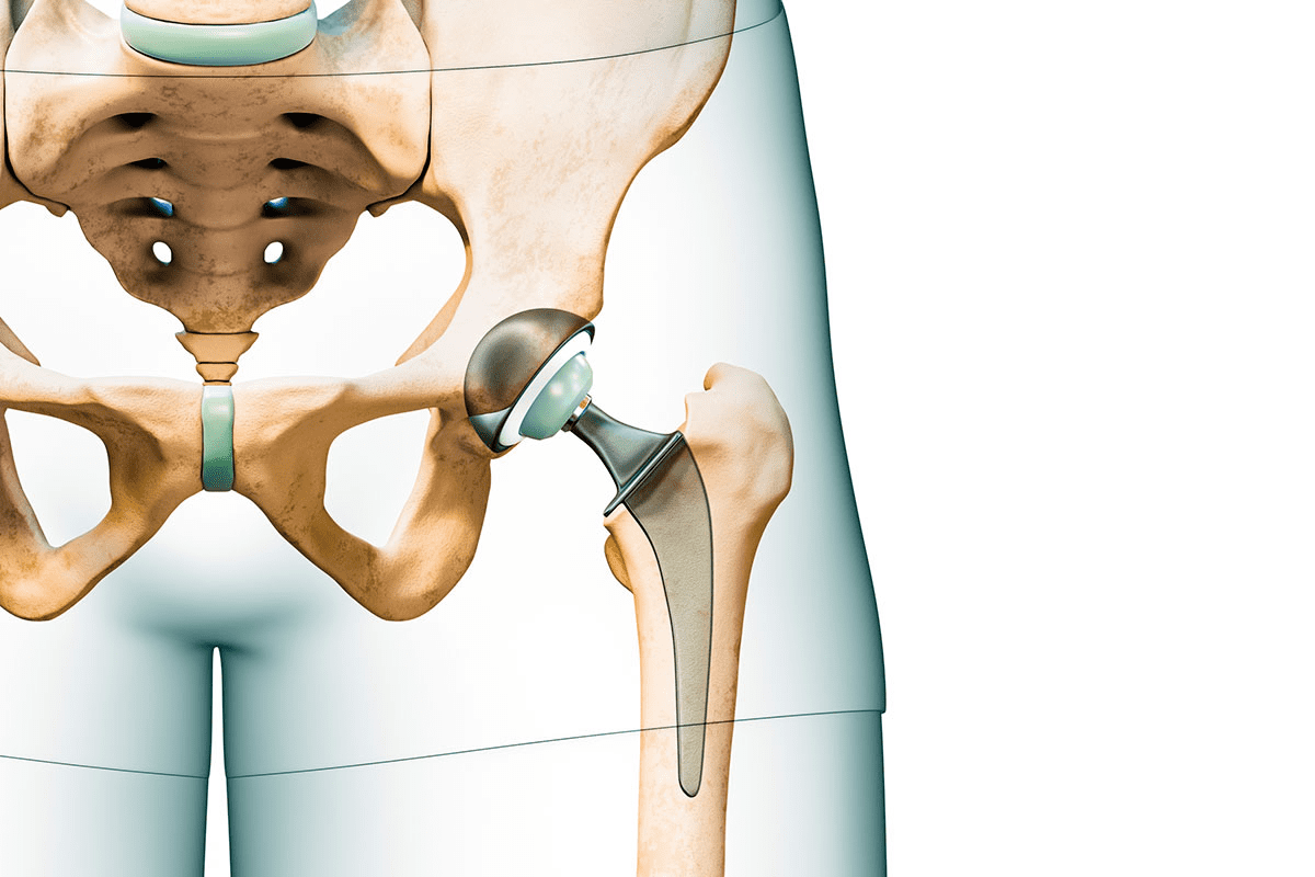 Sharp 12 Good Hip Exercises To Build Strength & Stability 3 image 1763978508266 LIV Hospital