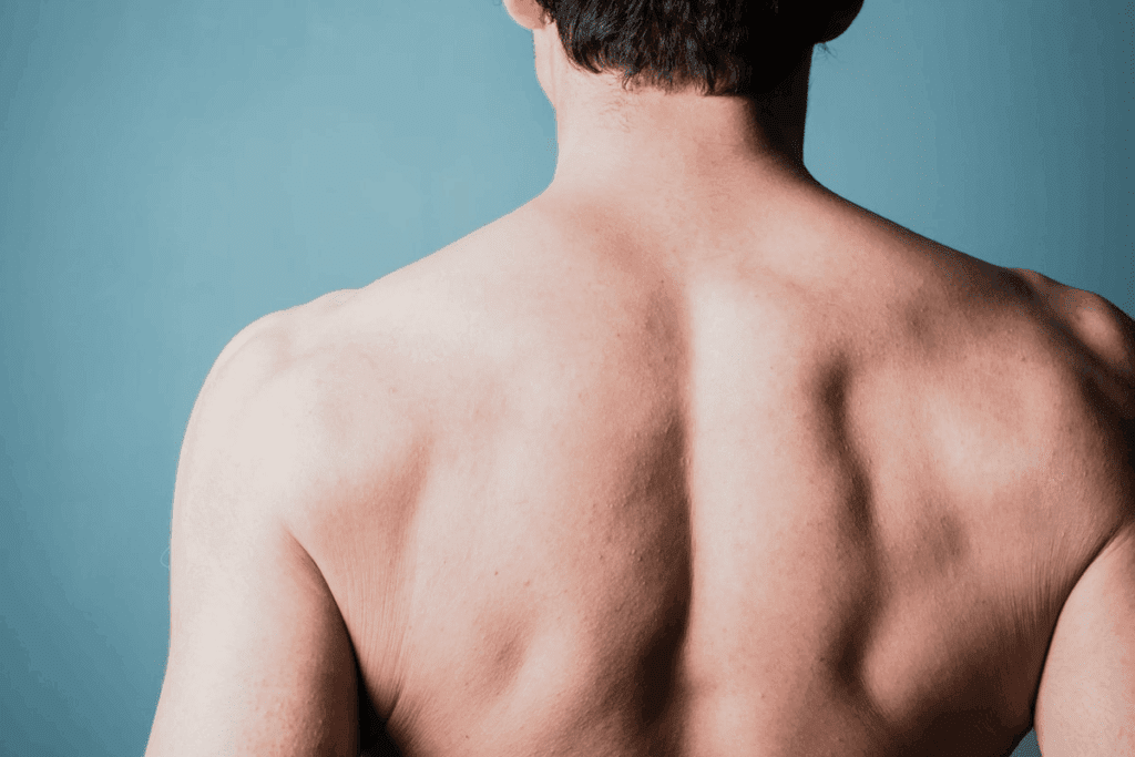Amazing 8 Effective Upper Spine Pain Stretches For Relief