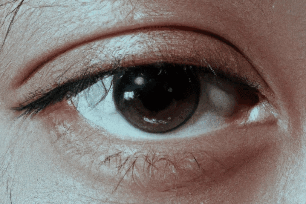 Complete Top 5 Reasons For Vision Loss Worldwide