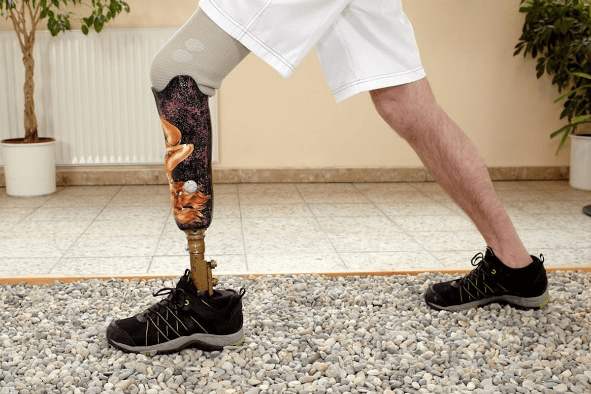 Profound How To Choose The Right Below Knee Prosthesis