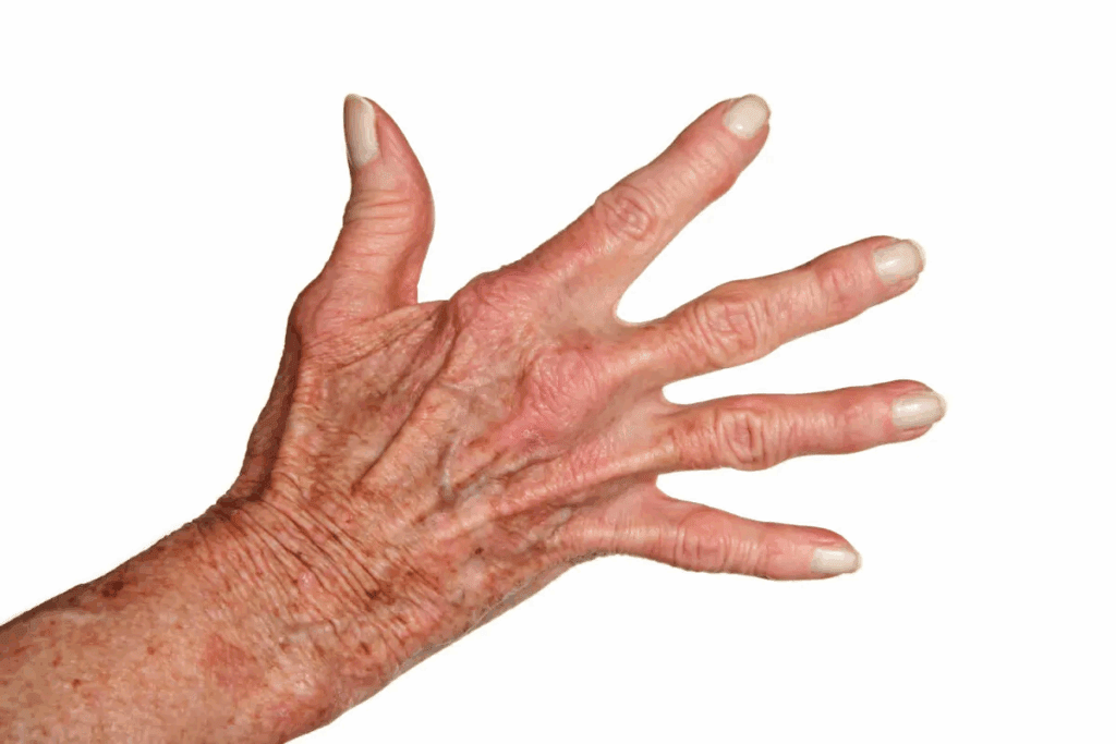 How to Help Arthritic Hands: 7 Proven Relief Methods