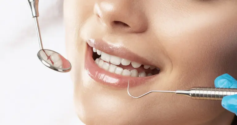 Teeth Whitening Common Symptoms