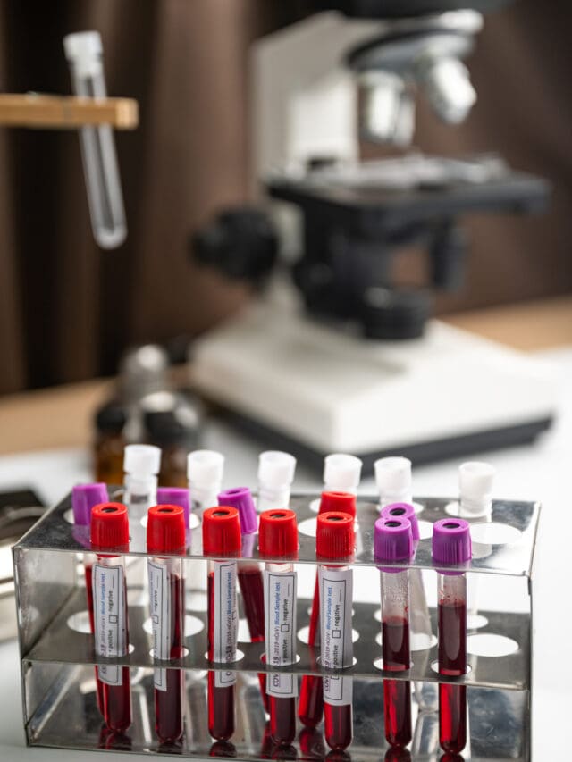 LIV GOLD CANCER SCREENING FOR MEN