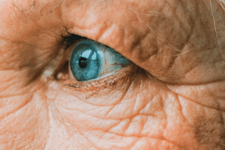 Diabetes eye examination: A Complete Guide