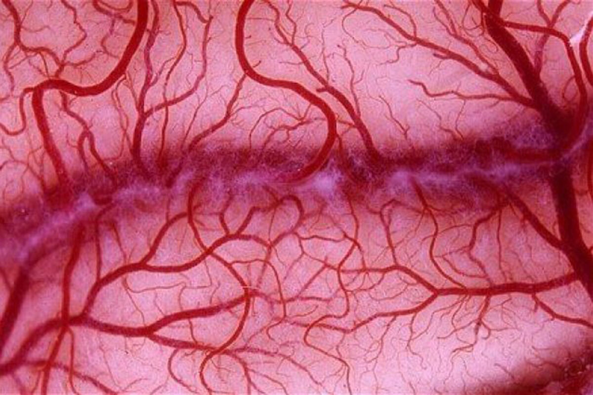 Key Why Do Red Veins Inside Eye Appear In The White? 2 Key Why Do Red Veins Inside Eye Appear In The White?