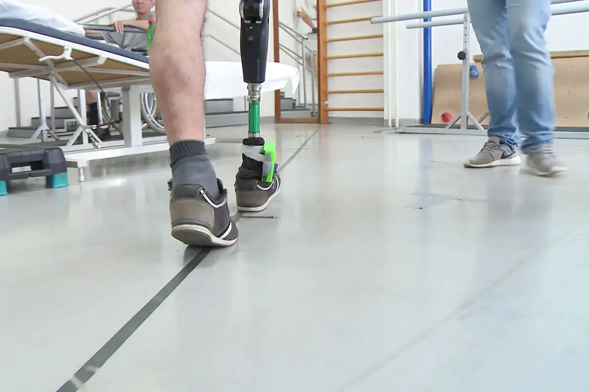 Living & rehab after bilateral above knee amputation