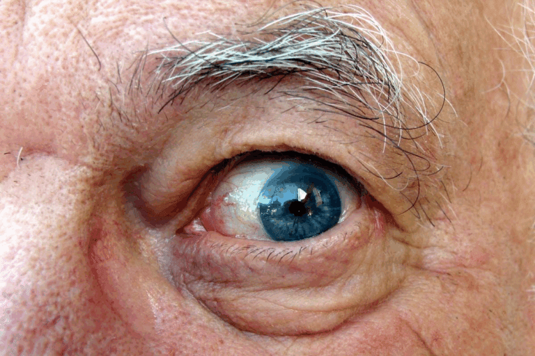 Essential How To Get Rid Of Baggy Eyes: 7 Proven Methods