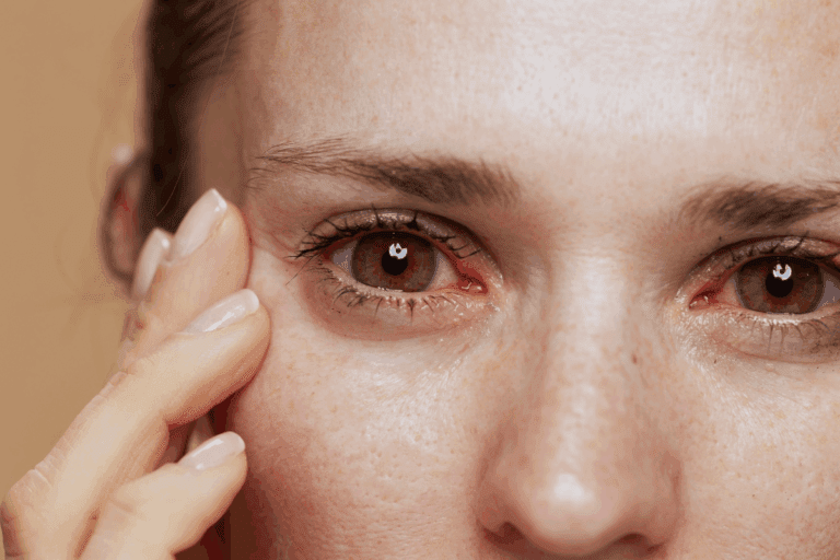 Amazing 7 Eye Muscle Problems: Types, Symptoms & Treatment