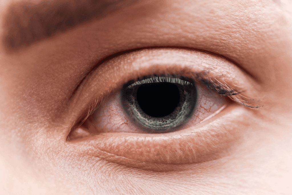 What Autoimmune Disease Attacks the Eyes? Find Out