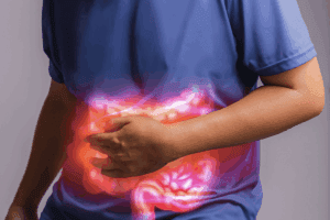 Diverticulitis Pain: The Shocking, Honest Truth