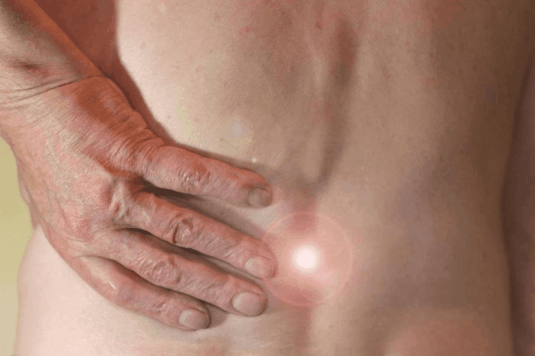 Hernia Fatigue Symptoms: The Surprising, Hidden Cause