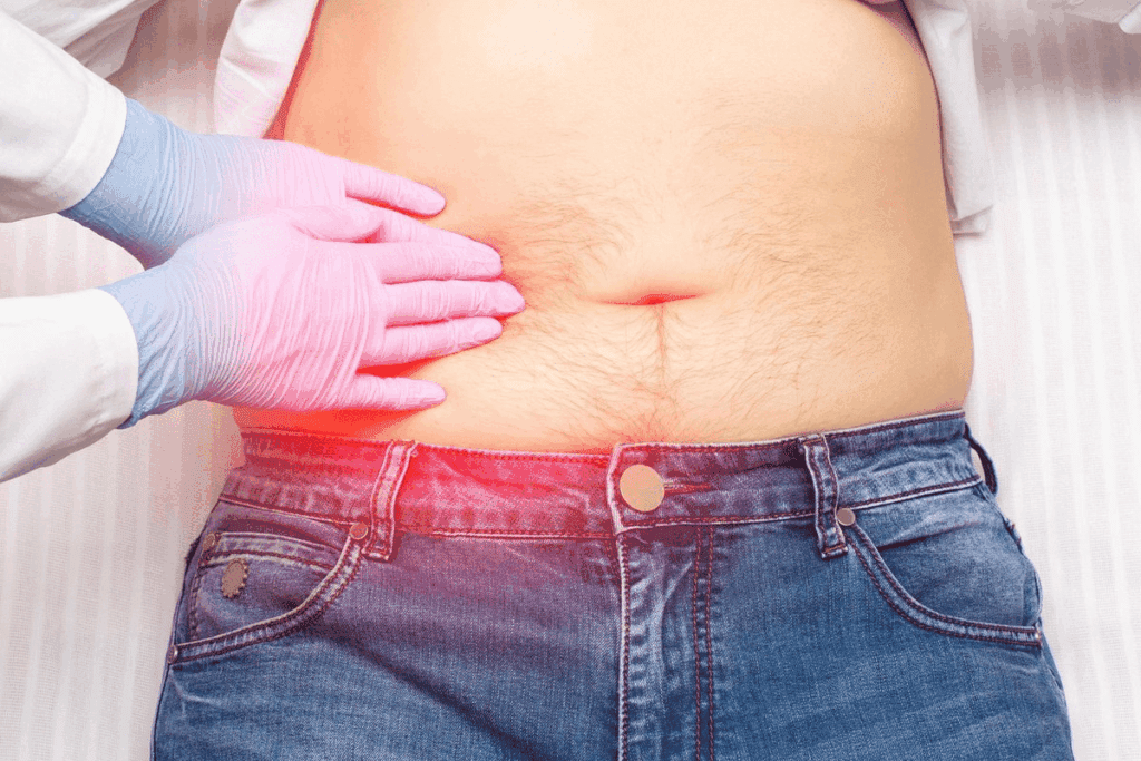 Gallstones Cause Fatigue: The Surprising Symptom