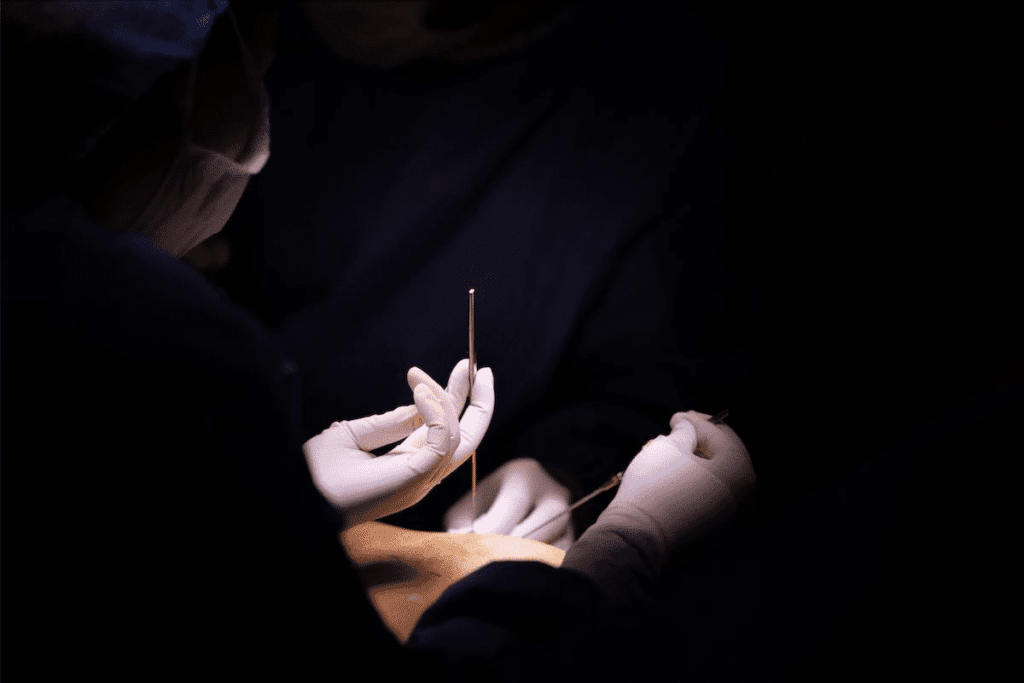 Living with Umbilical Hernia: An Amazing Guide