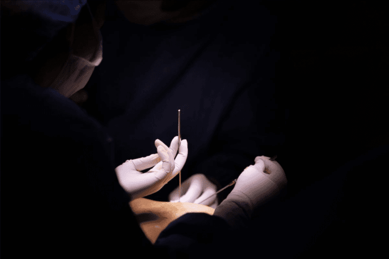 Living with Umbilical Hernia: An Amazing Guide