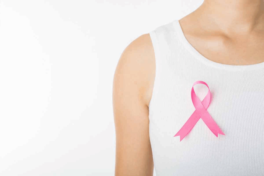 Cancer-Free After Breast Cancer: An Expert Guide