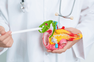 Dietary Restrictions After Gastric Sleeve