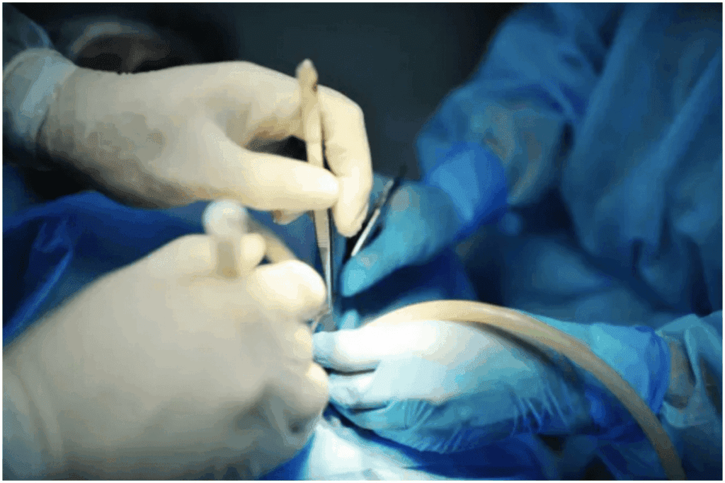 Prepare Gastrointestinal Surgery Tips