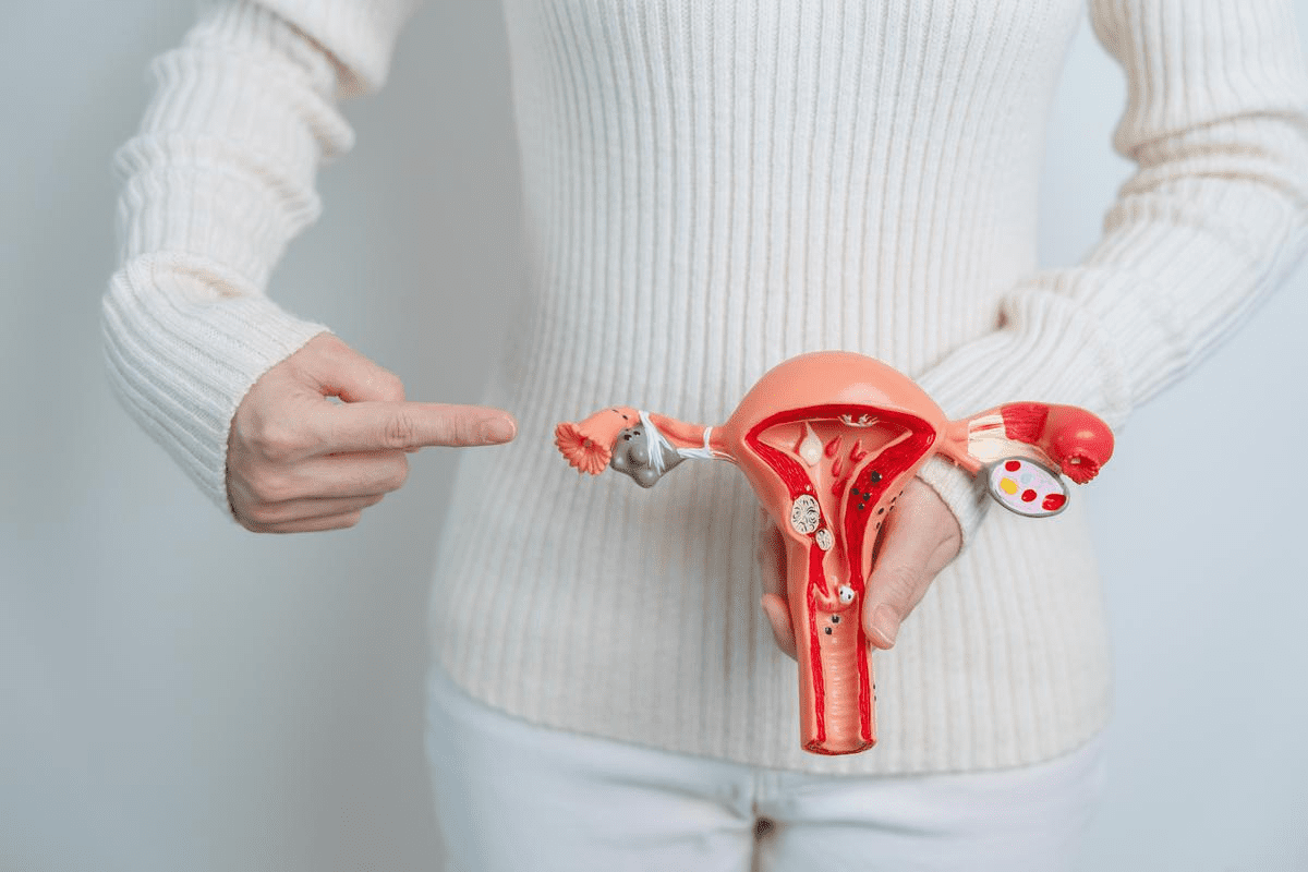PCOS and Abnormal Bleeding: Alarming Causes & Fixes - Liv Hospital