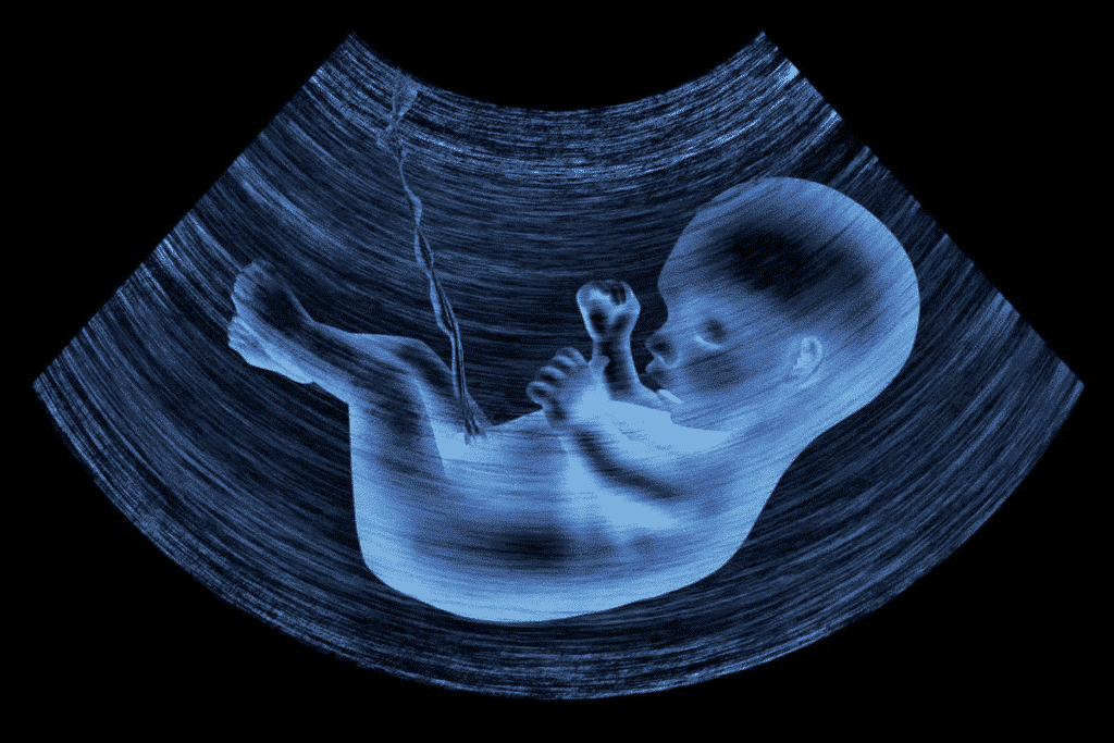 Ultimate Is 9 Week Ultrasound Internal Or External?
