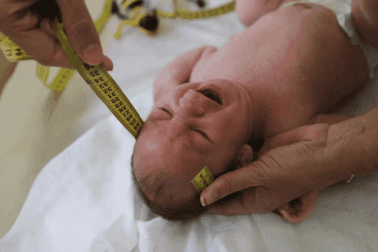 FL AC Ultrasound Meaning: The Critical Guide