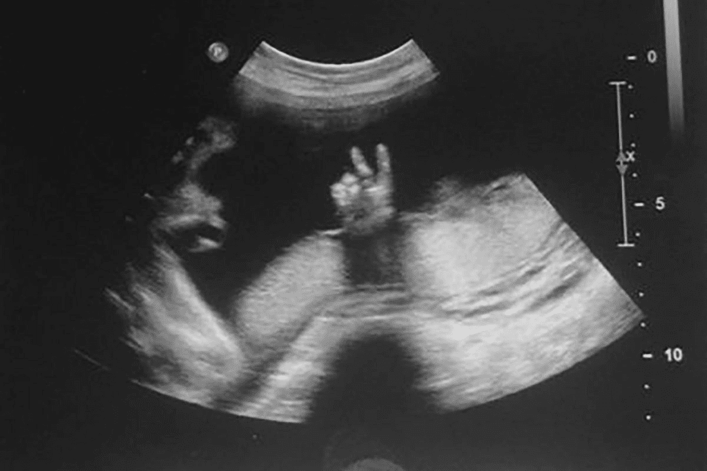 50 and Cramps but No Period: What It Means