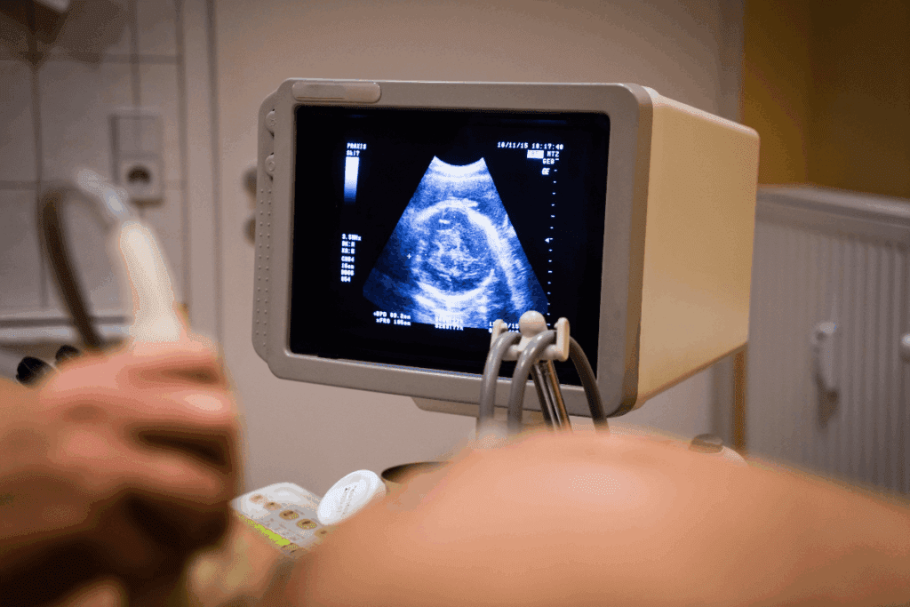 Fetal Biometry BPD: The Ultimate Guide