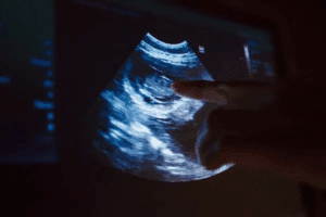 Insightful What To Expect At 9 Weeks 5 Days Pregnant