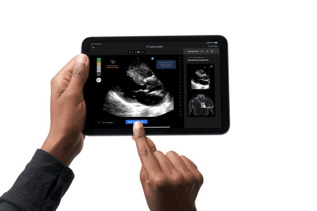 Key 9 Week Gestation Ultrasound: Symptoms & Size