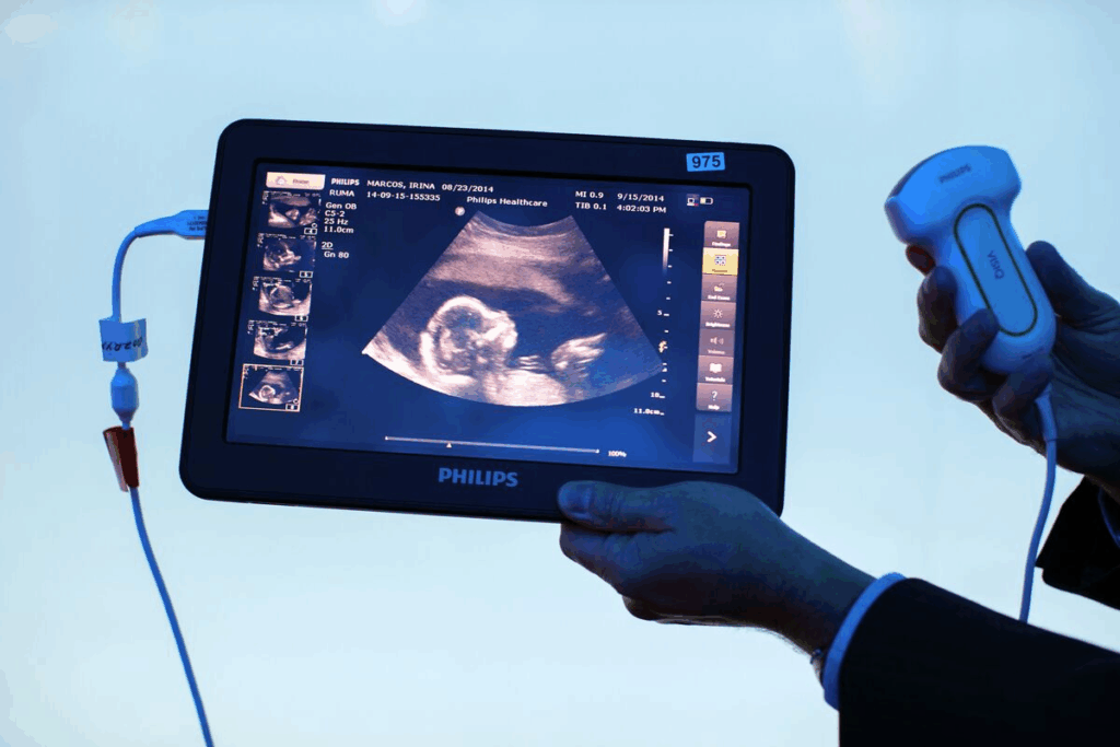 7 Weeks 3 Days Ultrasound: What to Expect