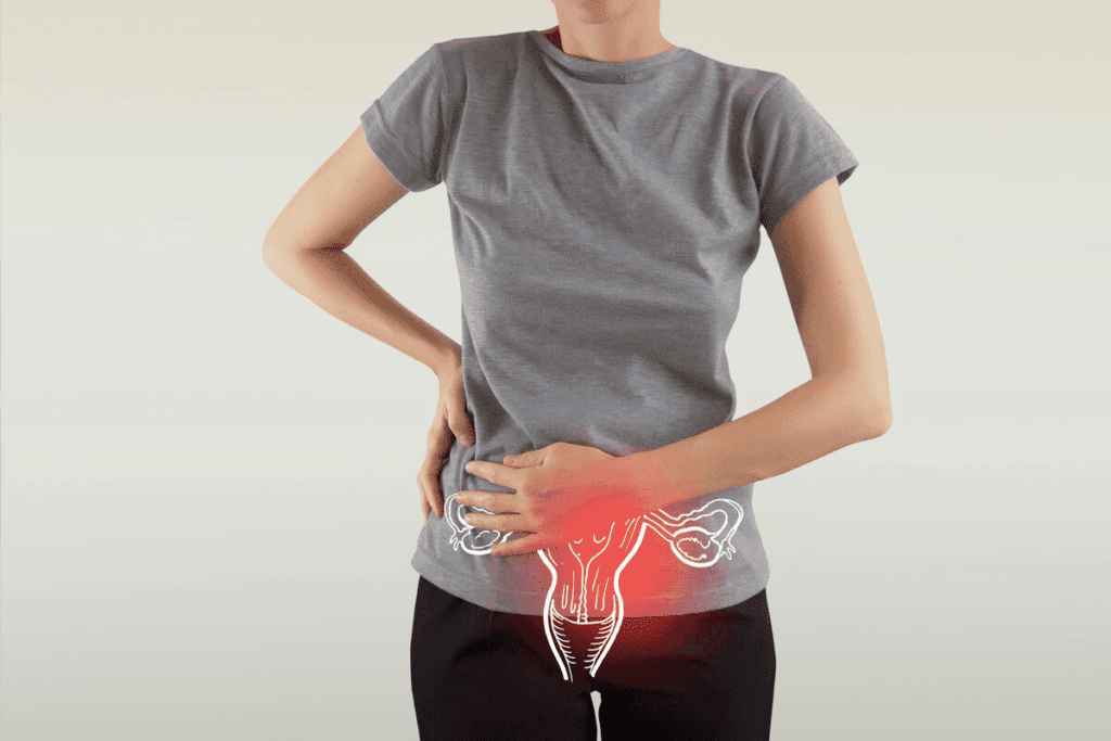 Can Endometriosis Cause Back Pain? Surprising Facts