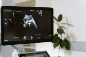 Sharp 3D & 4D Ultrasound: 8 Week Ultrasound 3D Guide