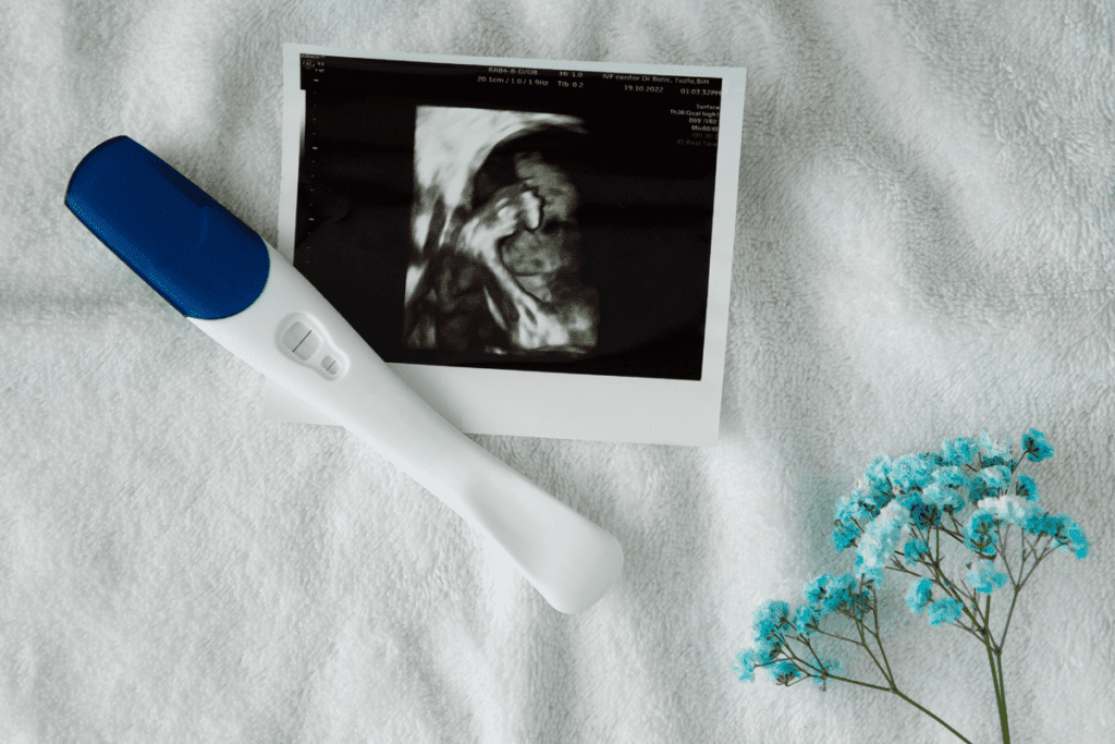 Sharp 10 week ultrasound abdominal: What To Expect At Your Abdominal Scan