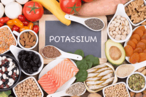 Top 10 High Potassium Foods Beyond Bananas: Building a Diet Rich in Potassium