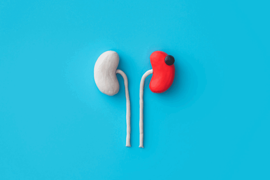 What Is the Creatinine Level for Stage 4 Kidney Disease?