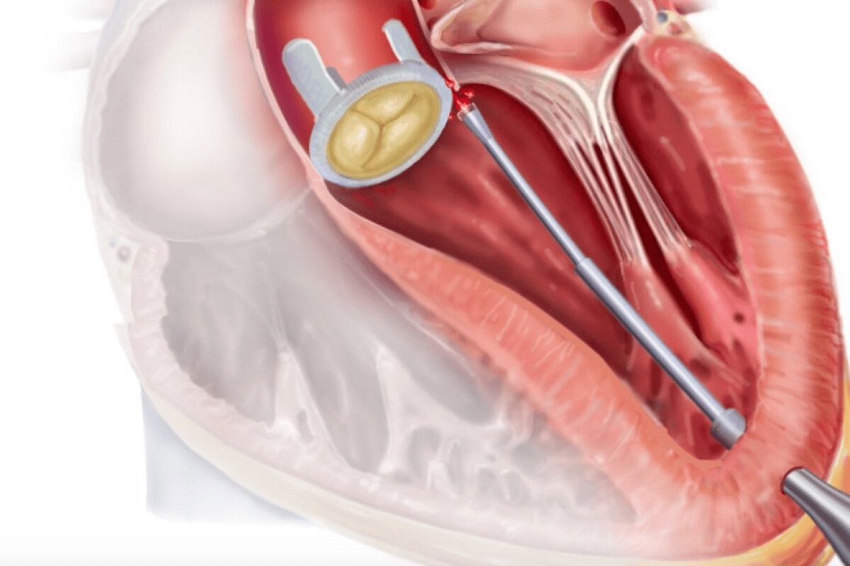 image 7446 LIV Hospital