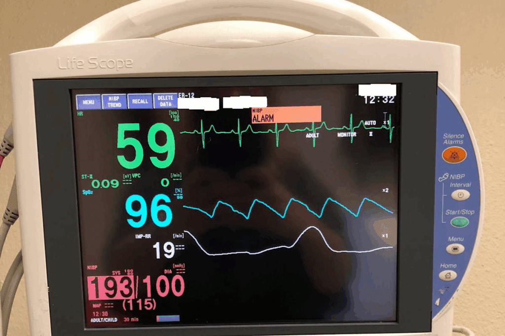 What Is a Heart Ablation & Why Monitoring Is Vital 1 What Is a Heart Ablation & Why Monitoring Is Vital