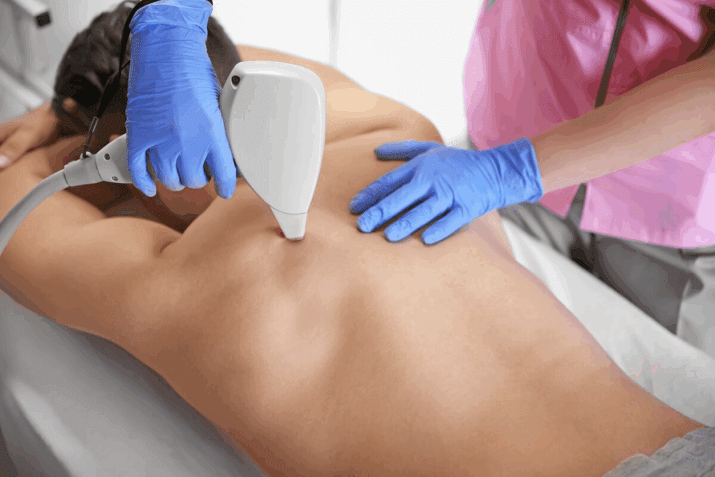 Laser Skin Resurfacing Before and After: Results Guide 1 Laser Skin Resurfacing Before and After: Results Guide