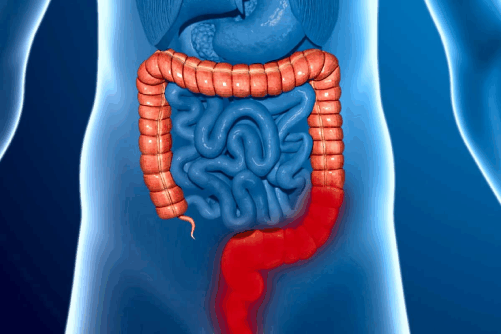 What is the Right Colon and How Does It Differ from the Left?