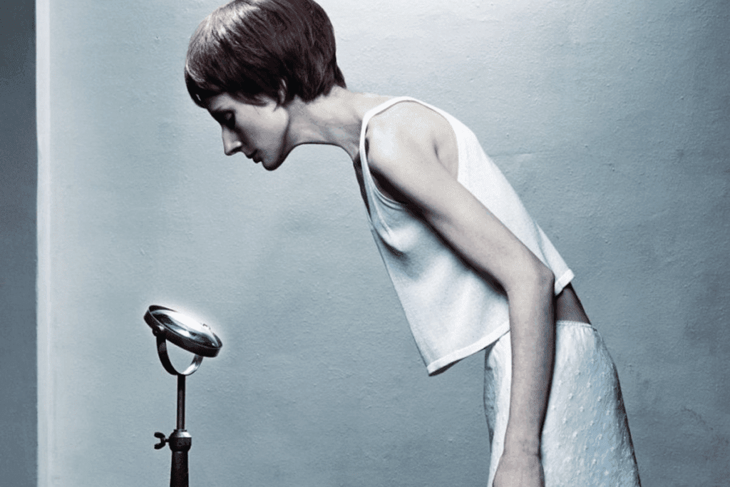 Do I Have Anorexia Quiz? Get Simple, Fast Answers 3 Do I Have Anorexia Quiz? Get Simple, Fast Answers