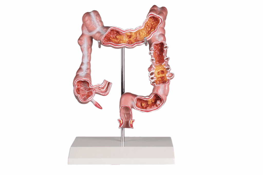 What Is the Difference Between Your Colon and Rectum? 2 What Is the Difference Between Your Colon and Rectum?