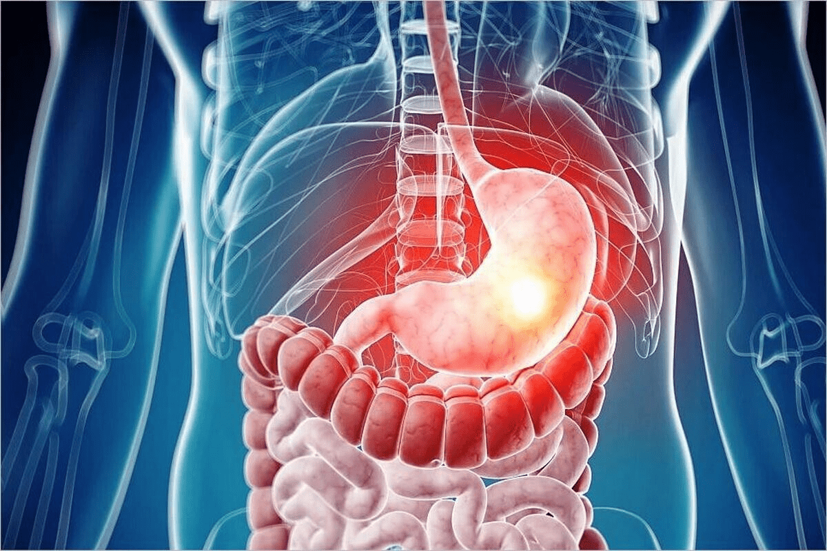 What Causes Constipation? 7 Alarming Reasons & Fixes