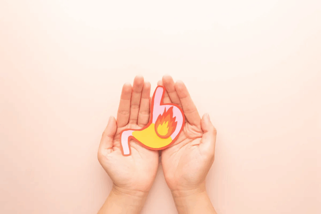 Does Chocolate Cause Heartburn? 10 Alarming Foods