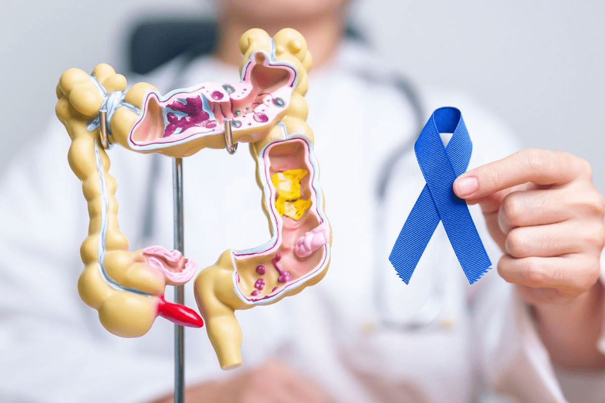 Colorectal Cancer Screening Test: 5 Best Options