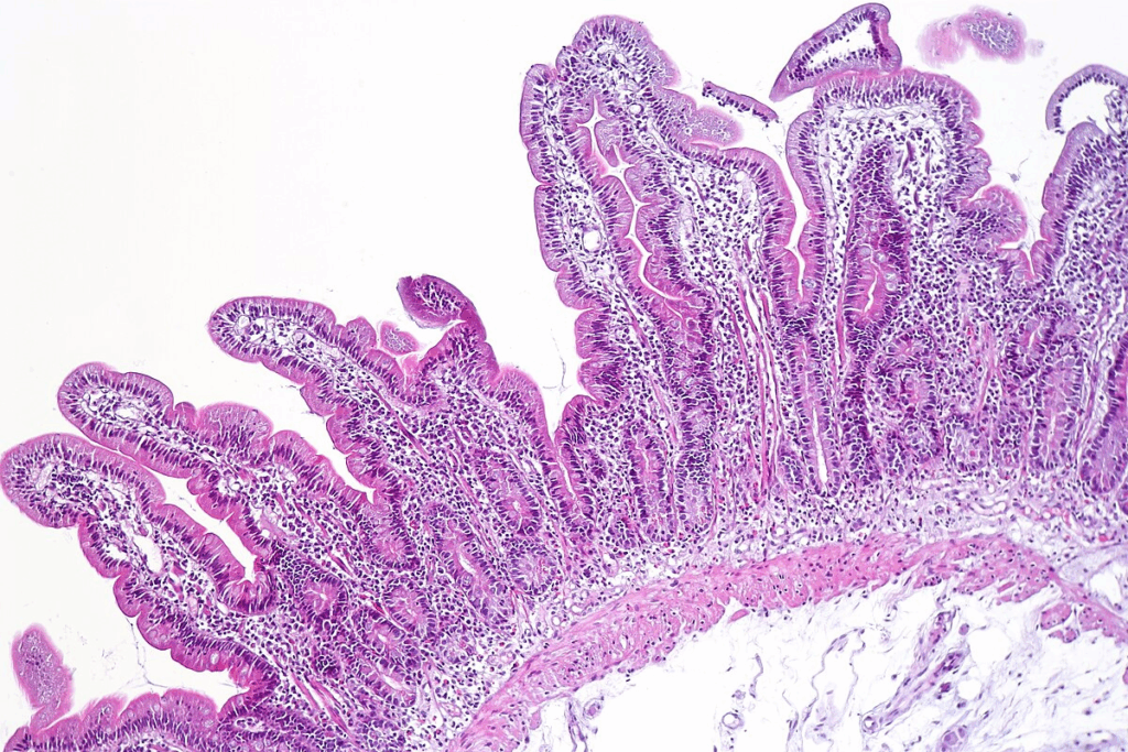 What Is a Duodenal Bulb and Why Does It Matter?